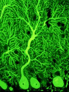 運動制御と運動学習を制御する小脳のプルキンエ細胞の可視化