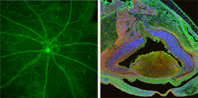 左図：実験的ぶどう膜炎・網膜炎モデルマウスにおける網膜血管への白血球接着　右図：マウス胎児網膜における(プロ)レニン受容体(赤色)、β-カテニン(緑色)と核(青色)の多重染色