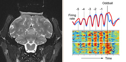サルのMRI画像・小脳核ニューロンの活動