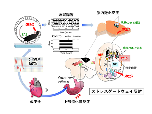 ストレスゲートウェイ反射の仕組み